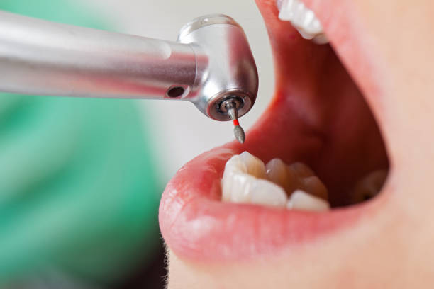 Best Emergency Dentist for Knocked-Out Tooth in New Hyde Park, NY